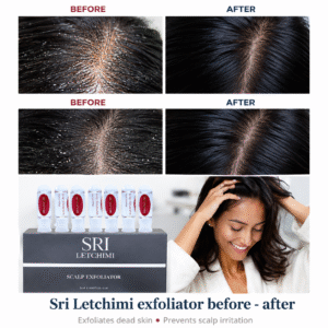 Scalp Exfoliator | Golden Shine HQ